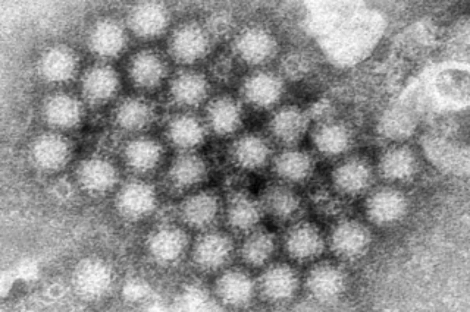 El norovirus regresa con fuerza y los casos en Estados Unidos aumentan notablemente