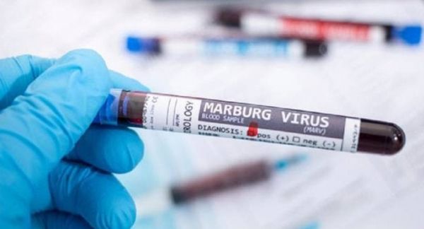 Virus Marburgo cobra su primer víctimas; OMS pide detenerlo en seco