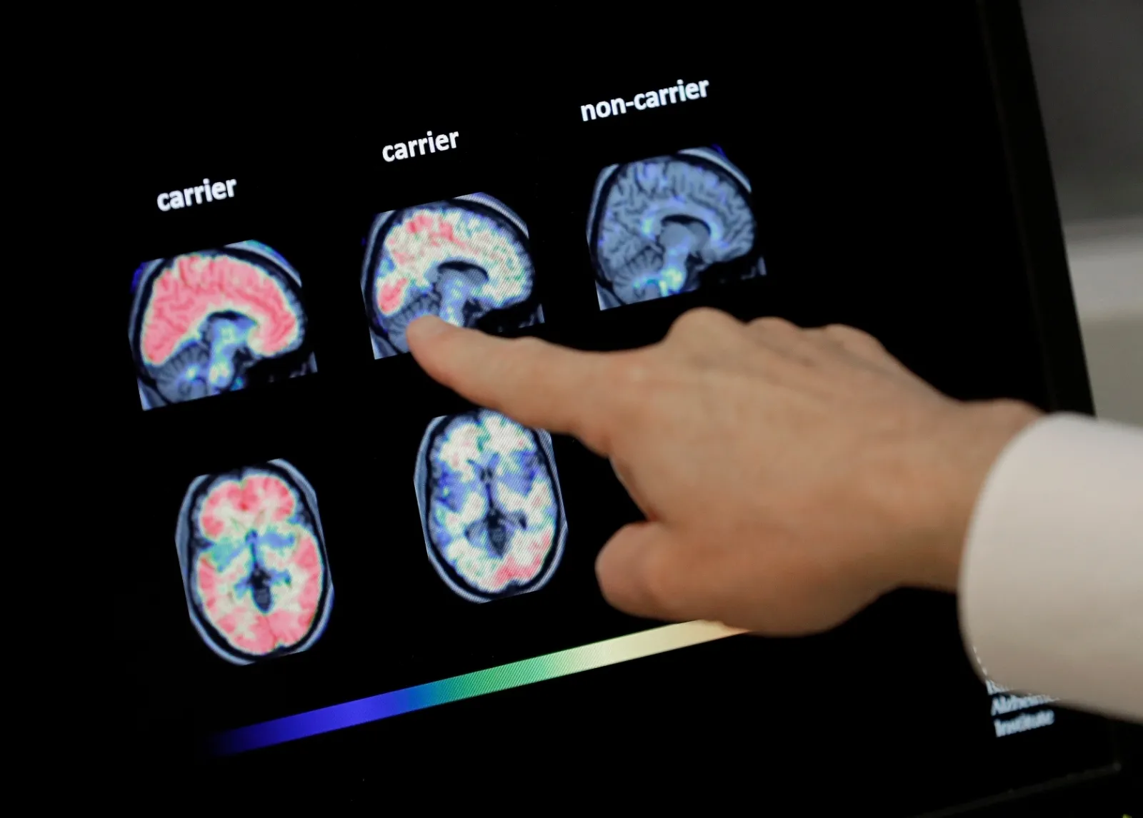 Vivir más tiempo podría aumentar el riesgo de demencia, pero hay formas de reducirlo